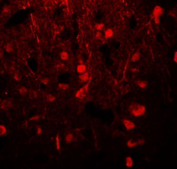 Immunofluorescence of Alpha-tubulin in human brain tissue with Alpha-tubulin antibody at 20 μg/mL