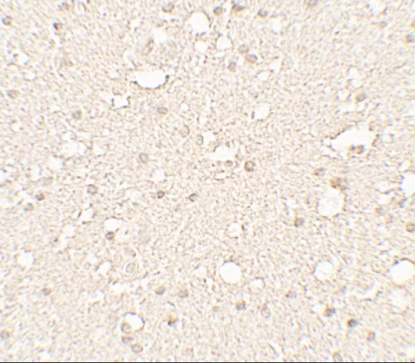 Immunohistochemistry of Alpha-tubulin in human brain tissue with Alpha-tubulin antibody at 5 μg/mL
