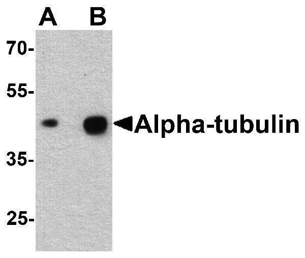 Western blot analysis of alpha-tubulin in human brain tissue lysate with alpha-tubulin antibody at (A) 0