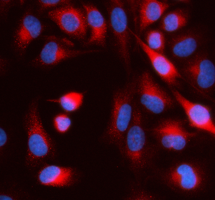 a17847 1 midn primary antibodies if testing 1