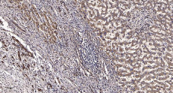 a17849 serpina11 primary antibodies ihc testing 1