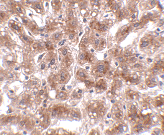 Immunohistochemistry of CUEDC1 in human liver tissue with CUEDC1 antibody at 2 μg/mL
