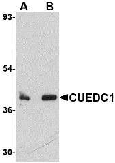 Western blot analysis of CUEDC1 in rat liver tissue lysate with CUEDC1 antibody at (A) 0