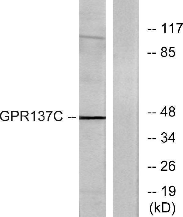 Western blot analysis of lysates from HepG2 cells, using GPR137C Antibody