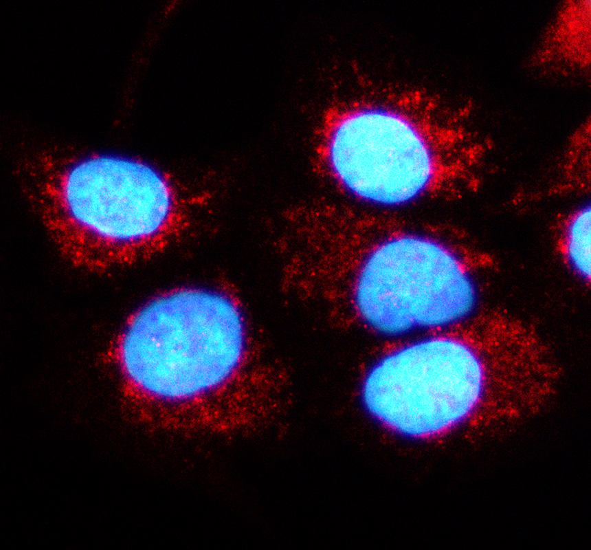a17987 lrrc43 primary antibodies if testing 1