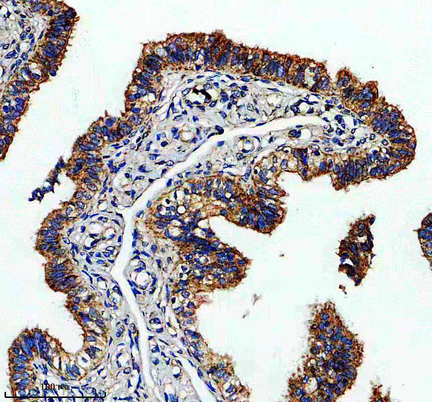 a17987 lrrc43 primary antibodies ihc testing 1