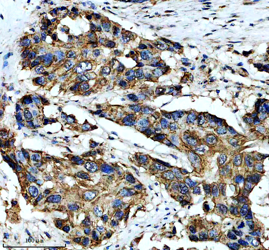 a17987 lrrc43 primary antibodies ihc testing 2