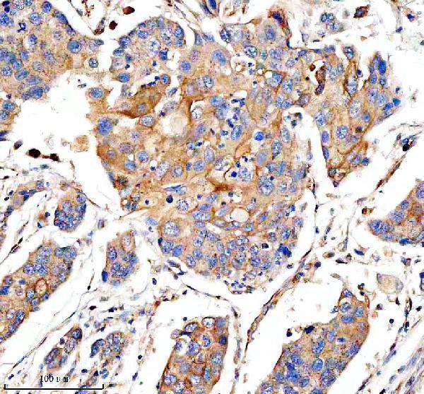 a18010 phldb3 primary antibodies ihc testing 2