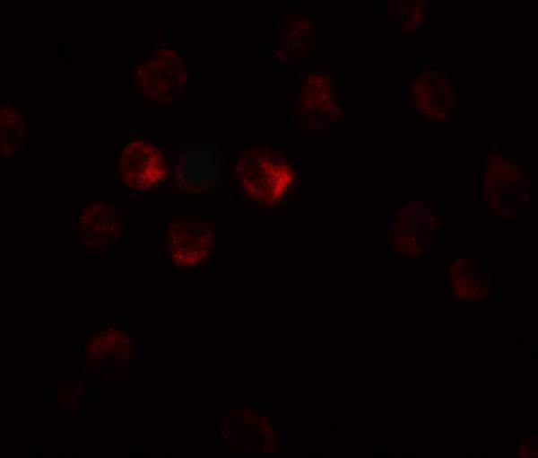 Immunofluorescence of TCTEX1D1 in K562 cells with TCTEX1D1 antibody at 20 μg/mL