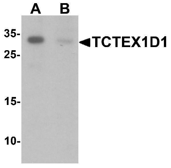 Western blot analysis of TCTEX1D1 in K562 cell lysate with TCTEX1D1 antibody at 1 μg/mL in (A) the absence and (B) the presence of blocking peptide