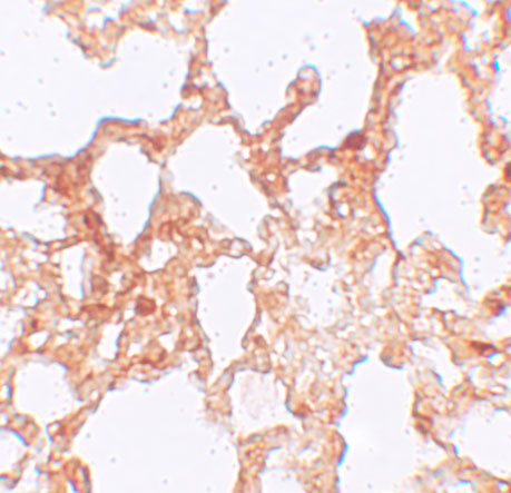 a18075 zmym1 primary antibodies ihc testing 2