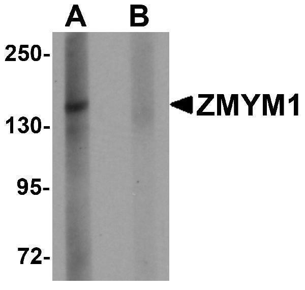 a18075 zmym1 primary antibodies wb testing 1