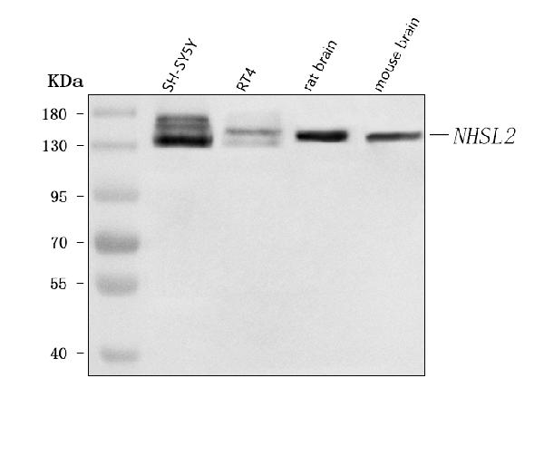 Figure 1. Western blot analysis of NHSL2 using anti-NHSL2 antibody (A18099). Electrophoresis was performed on a 5-20% SDS-PAGE gel at 70V (Stacking gel) / 90V (Resolving gel) for 2-3 hours. The sample well of each lane was loaded with 30 ug of sample under reducing conditions. Lane 1: human SH-SY5Y whole cell lysates, Lane 2: human RT4 whole cell lysates, Lane 3: rat brain tissue lysates, Lane 4: mouse brain tissue lysates. After electrophoresis, proteins were transferred to a nitrocellulose membrane at 150 mA for 50-90 minutes. Blocked the membrane with 5% non-fat milk/TBS for 1.5 hour at RT. The membrane was incubated with rabbit anti-NHSL2 antigen affinity purified polyclonal antibody (Catalog # A18099) at 0.5 microg/mL overnight at 4°C, then washed with TBS-0.1%Tween 3 times with 5 minutes each and probed with a goat anti-rabbit IgG-HRP secondary antibody at a dilution of 1:5000 for 1.5 hour at RT. The signal is developed using an Enhanced Chemiluminescent detection (ECL) kit (Catalog # EK1002) with Tanon 5200 system. A specific band was detected for NHSL2 at approximately 133 kDa. The expected band size for NHSL2 is at 133 kDa.