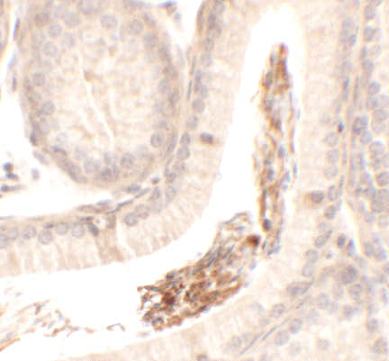 a18198 spata1 primary antibodies ihc testing 2