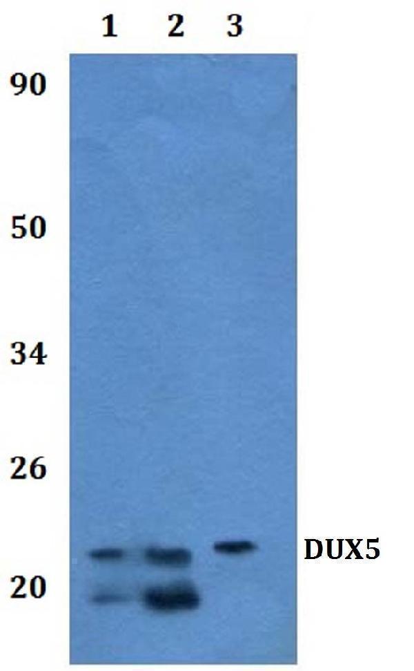 a18215 1 dux5 primary antiboties wb testing 1
