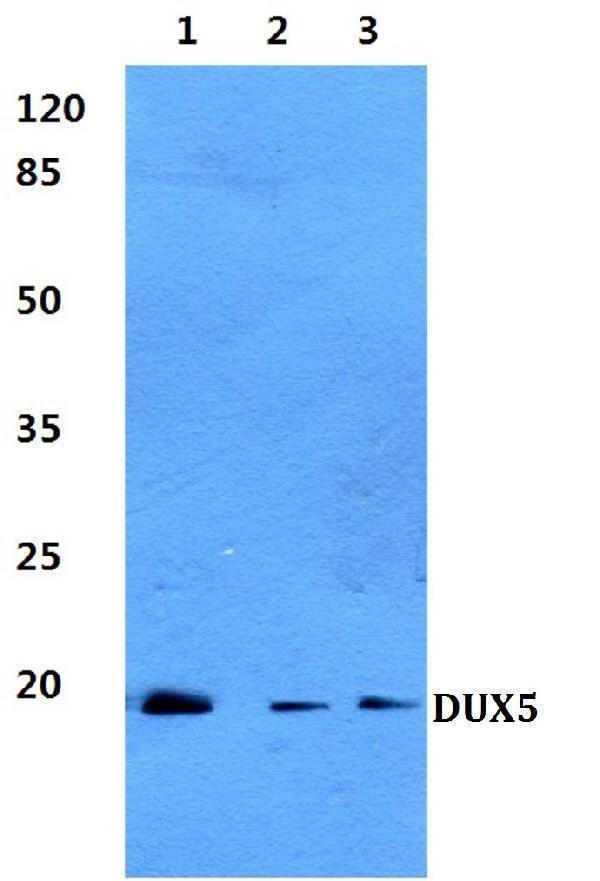 Western blot (WB) analysis of DUX5 polyclonal antibody at 1:500 dilution
Lane1:HepG2 cell lysate
Lane2:H9C2 cell lysate
Lane3:Rat liver tissue lysate