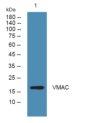 Western blot analysis of lysates from U2OS cells, primary antibody was diluted at 1:1000, 4°over night