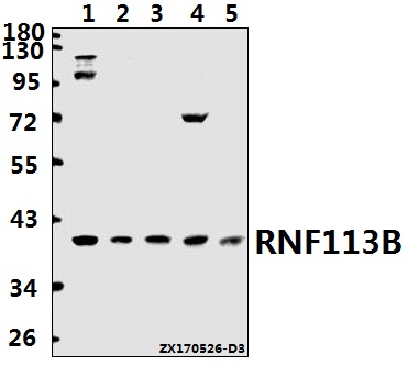 Western blot (WB) analysis of RNF113B polyclonal antibody at 1:500 dilution
Lane1:HEK293T whole cell lysate(40ug)
Lane2:HepG2 whole cell lysate(40ug)
Lane3:MCF-7 whole cell lysate(40ug)
Lane4:C6 whole cell lysate(40ug)
Lane5:AML-12 whole cell lysate(40ug)