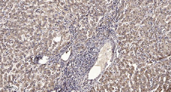 a18242 rnf113b primary antibodies ihc testing 1