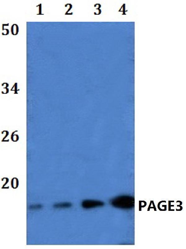 a18245 page3 primary antiboties wb testing 1