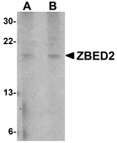 Western blot analysis of ZBED2 in A549 cell lysate with ZBED2 antibody at (A) 1 and (B) 2 μg/mL