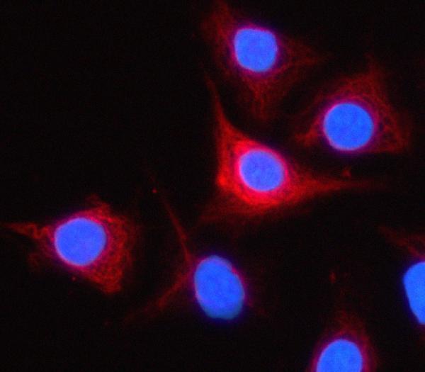 a18279 1 prss44 primary antibodies if testing 2