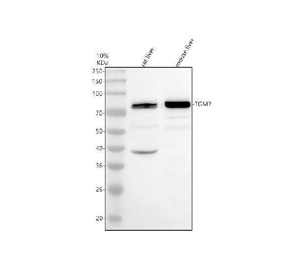 Western blot analysis of TGM7 using anti-TGM7 antibody (A18282-2)