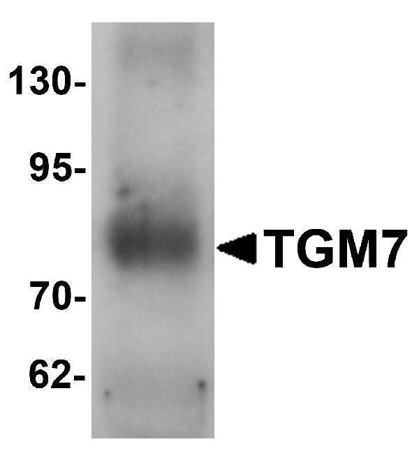 a18282 tgm7 primary antibodies wb testing 1