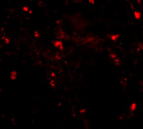 a18306 rgpd5 primary antibodies if testing 3