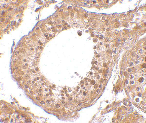 a18306 rgpd5 primary antibodies ihc testing 2