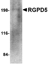 a18306 rgpd5 primary antibodies wb testing 1