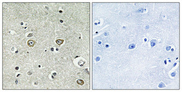 Immunohistochemical analysis of paraffin-embedded Human brain