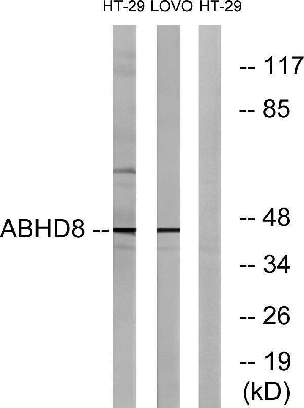 Western blot analysis of lysates from HT-29 and LOVO cells, using ABHD8 Antibody