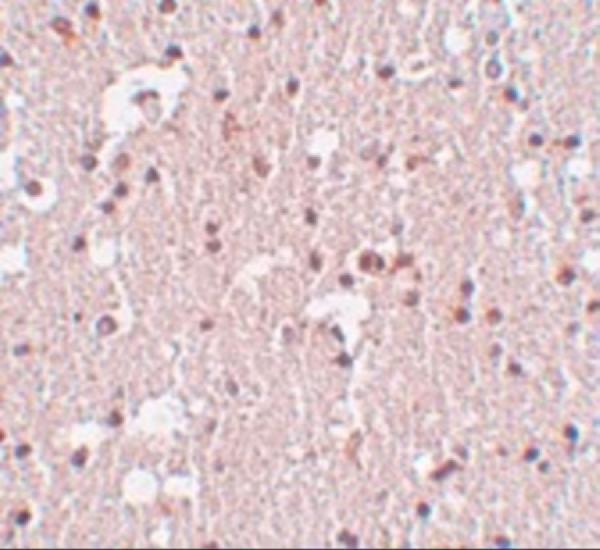 Immunohistochemistry of FRMPD3 in human brain tissue with FRMPD3 antibody at 5 μg/mL