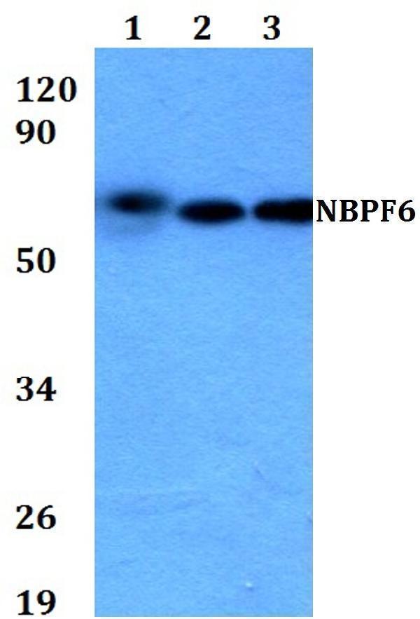 a18480 nbpf6 primary antiboties wb testing 1
