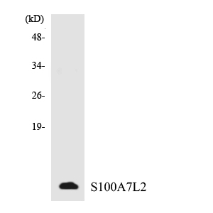 a18516 s100a7l2 primary antibodies wb testing 1