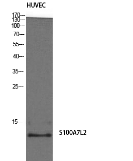 a18516 s100a7l2 primary antibodies wb testing 2