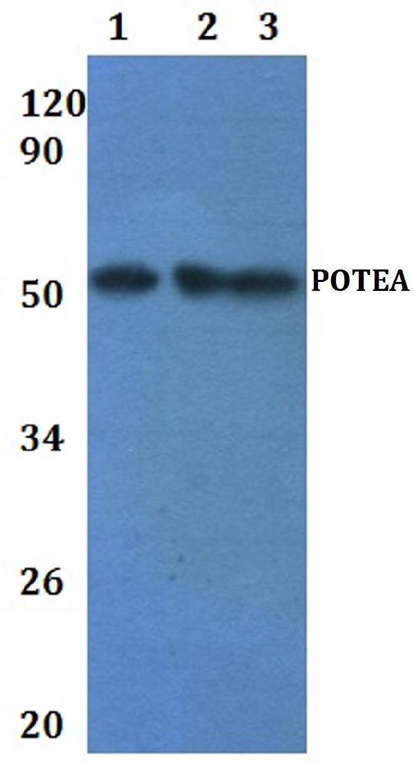 a18602 1 potea primary antiboties wb testing 1