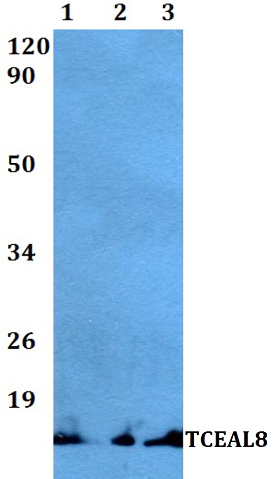 Western blot (WB) analysis of TCEAL8 polyclonal antibody at 1:500 dilution
Lane1:Hela whole cell lysate
Lane2:Raw264