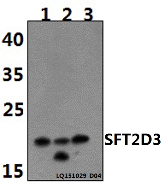 a18615 sft2d3 primary antiboties wb testing 1