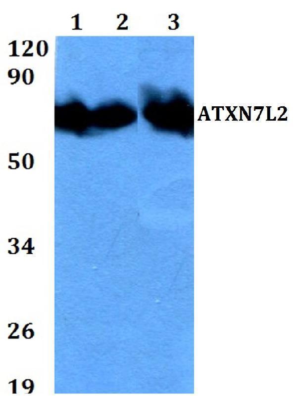 Western blot (WB) analysis of ATXN7L2 polyclonal antibody at 1:500 dilution
Lane1:HEK293T whole cell lysate
Lane2:Raw264