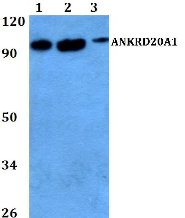 Western blot (WB) analysis of ANKRD20A1 polyclonal antibody at 1:500 dilution
Lane1:Hela whole cell lysate
Lane2:sp2/0 whole cell lysate 
Lane3:PC12 whole cell lysate 