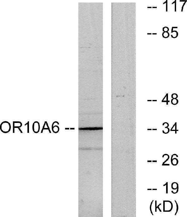 Western blot analysis of lysates from A549 cells, using OR10A6 Antibody