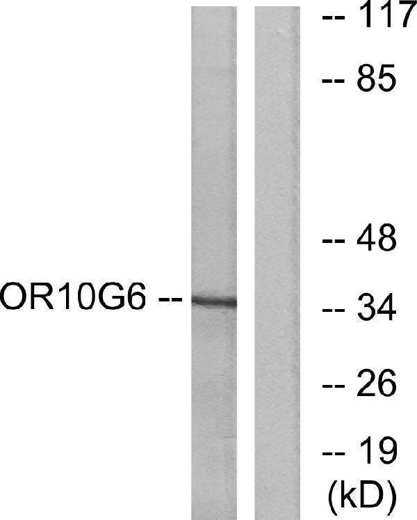 Western blot analysis of lysates from COLO cells, using OR10G6 Antibody