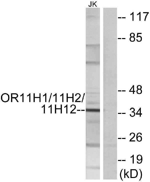 Western blot analysis of lysates from Jurkat cells, using OR11H1/11H2/11H12 Antibody