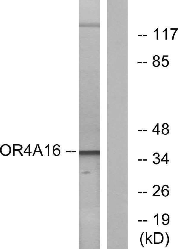 Western blot analysis of lysates from COLO cells, using OR4A16 Antibody