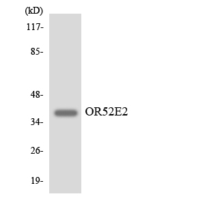 Western blot analysis of the lysates from HeLa cells using OR52E2 antibody