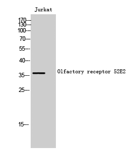 Western Blot analysis of Jurkat cells using Olfactory receptor 52E2 Polyclonal Antibody