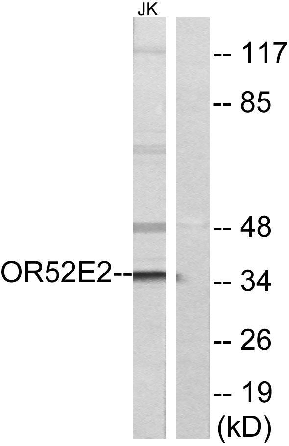 Western blot analysis of lysates from Jurkat cells, using OR52E2 Antibody