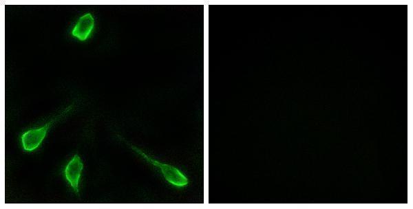a18782 or52e4 primary antibodies if testing 1